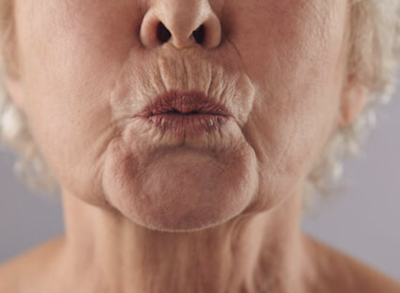 Close-up of an older person’s face with light skin, pursing their lips as if to whistle or blow a kiss. Wrinkles and fine lines are visible around the mouth and chin.