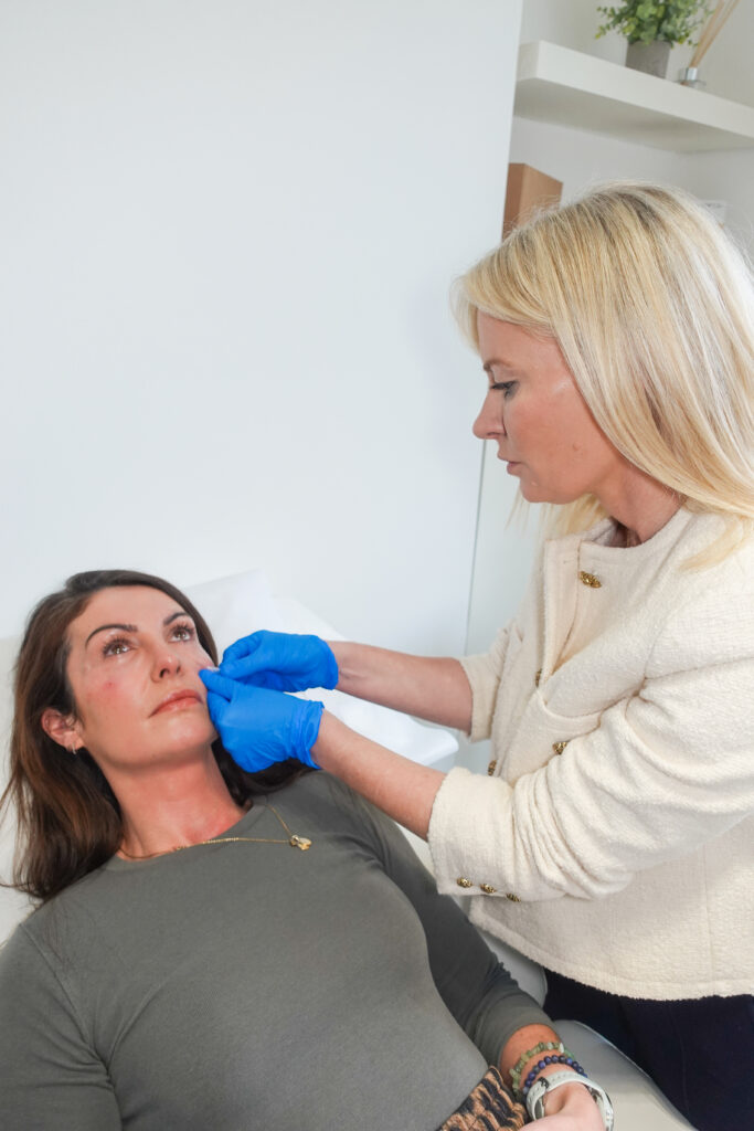 JULÄINE™ vs dermal fillers